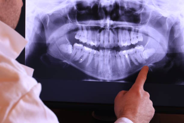 Best Chipped Tooth Repair Near Me  in Medina, TX